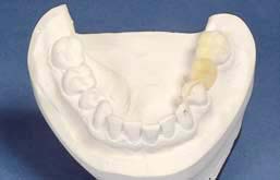 RESTORATIVE DESIGN & PRACTICAL OCCLUSIO… RESTORATIVE DESIGN & PRACTICAL OCCLUSIO… RESTORATIVE DESIGN